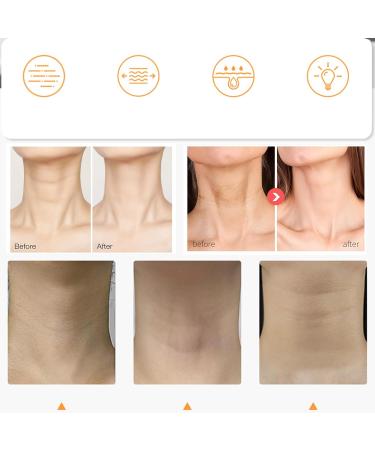  G n rique Lifting Neck Cream Hard Neck Cream 120g Hexapeptide Neck Care Cream | Natural Skin Care Product for Women Nourishing Moisturizer Non-Greasy Hexapeptide Moisturizer - Buy Online on GoSupps.com