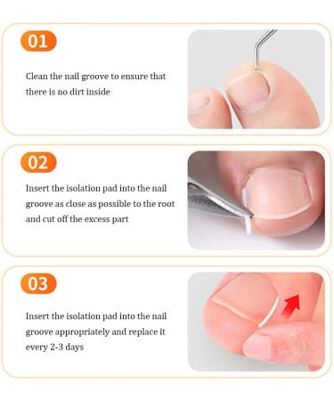 3 Pieces Toenail Straightener Strips Clear Ingrown Toenail Corrector Ingrown Toenail Groove for Women Men Nail Treatment Pedicure Tool - Buy Online on GoSupps.com