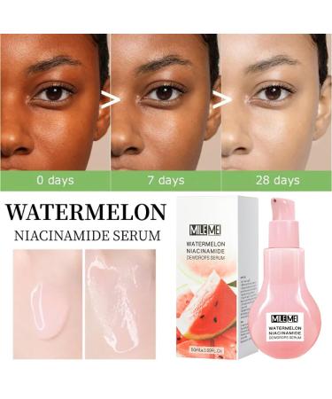 Watermelon Moisturizer Facial Serum - Hydrating Glow Priming Liquid Highlighter | International Shipping - Buy Online on GoSupps.com