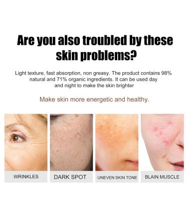 Tranacix Crema Mercas - Aclara Manchas Oscuras en la Cara | 2pcs - Efecto R pido y Eficaz - Buy Online on GoSupps.com