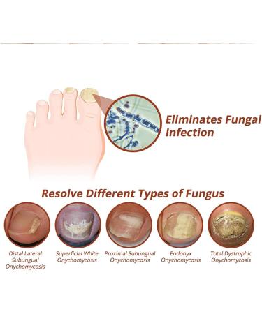 7 Days Nail Growth and Strengthening Serum Natural Nail Growth And Strength Serum Nail Repair Solution for Damaged and Discolored Nails Promotes Rapid Growth & Avoids Flaking (1pcs) - Buy Online on GoSupps.com