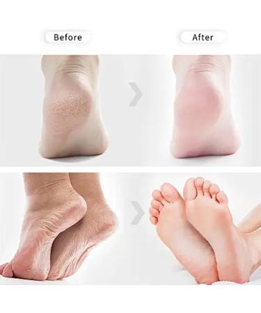 2 Pairs Foot Peel Mask for Hard Skin Exfoliating Foot Peel Mask Callus Remover For Feet Cracked Heel Treatment Foot Mask Peel Foot Moisturiser Socks for Cracked Heel Dead & Dry Skin Lavender - Buy Online on GoSupps.com