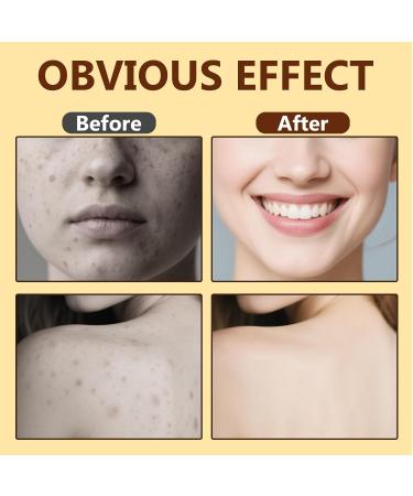 Bee Venom Cream Natural Bee Venom Skin Treatment Cream-for Removing and Repair Effective In Reducing Skin Blemishes Gentle and Non-irritating(Yellow) - Buy Online on GoSupps.com