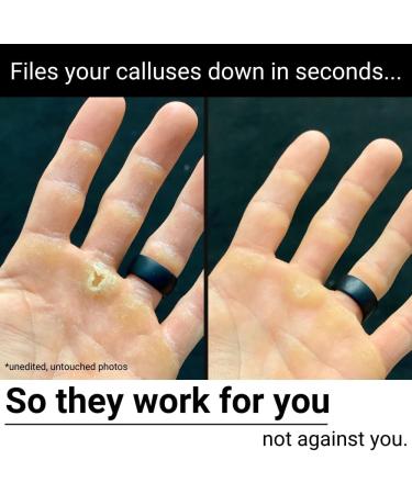 Buy SandBar Quickie Callus File - Ultimate Callus Tool for Hands | Includes Salve | International Shipping Available - Buy Online on GoSupps.com
