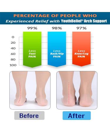Compression Arch Support Sleeves for Plantar Fasciitis - Cushioned Orthotic Relief for Flat Feet & Achy Feet - Men & Women - Buy Online on GoSupps.com