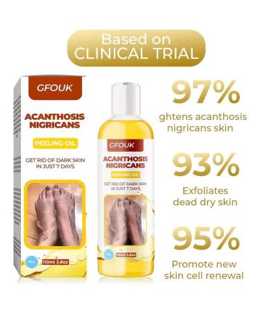GFOUK Acanthosis Nigricans Dark Spot Peeling Oil - 1pcs - Buy Online on GoSupps.com