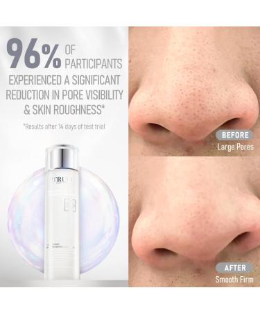 TRUU Skin Renewal Treatment Essence | Pore Refining Hydrating & Clarifying | Probiotics & Oxygenated Essence | Enhance Skin Barrier & Radiance | 5.3 Oz - Free International Shipping - Buy Online on GoSupps.com
