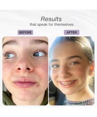 Buy Organic Papaya Pur e Face & Neck Plaster - Nourish Brighten & Fade Spots with Vitamin C | International Shipping Available - Buy Online on GoSupps.com