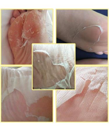 Weikeya Foot Peel Mask - Nourishing Lavender Oil Foot Masks for Dry Skin & Corn Removal | Unisex Foot Care Solution - Buy Online on GoSupps.com