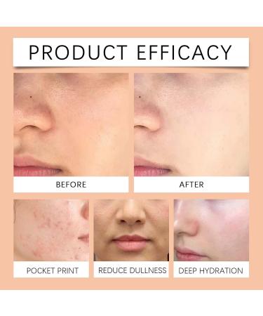 homomdy Vitamin C facial toner gentle and refreshing improves sebum production brightens the skin softens moisturizes shrinks pores reduces dark spots 3pcs - Buy Online on GoSupps.com