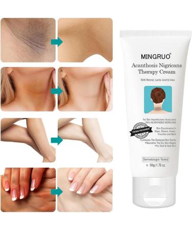 MINGRUO Dark Spot Removal Cream Dark Spot Correction Acanthosis Nigricans Therapy Cream for Dark Skin - Buy Online on GoSupps.com