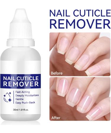 Dissolvant Pour Cuticules | Produits P dicure R parateurs Gel Hydratant Adoucissant Cuticules 30ml Pour Peau Morte Mains Et Pieds Pr paration Polissage Routine - Buy Online on GoSupps.com