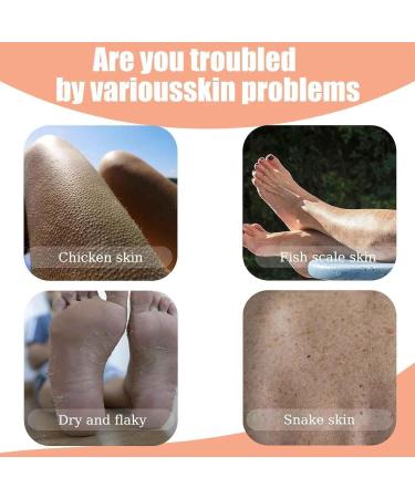 2Pcs strawberry Skin Treatment trawberry Legs Treatment Advanced Triple-Acid Complex Trystrawberry Resurfacing Cream Helps Reduce Chicken Skin Bumps Exfoliating Body Cream With Deep Hydration - Buy Online on GoSupps.com