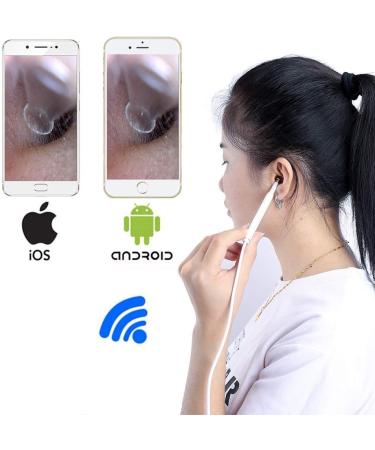 Jiusion WiFi USB Digital Otoscope - HD Ear Wax Removal Tool & Inspection Camera for iPhone Android Windows Mac Linux - Portable 6 LED Set (White) - Buy Online on GoSupps.com