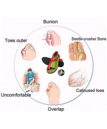 Shop Women s Orthopedic Wedge Sandals - Summer Beach Slippers & Bunion Correctors | Anti-Slip Platform Footwear EU Size 40 - Buy Online on GoSupps.com