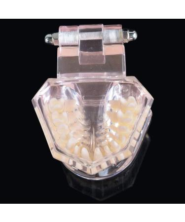 LBYLYH Orthodontic Demonstration Model - Teeth Teaching Tools with Metal & Ceramic Support for Effective Dental Treatment - Buy Online on GoSupps.com