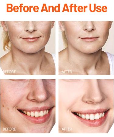 Viitamin C Skin Care Kit for Women Including Facial Cleanser Face Cream Face Toner Serum Smooth Deep Fine Lines Moisturizer - Buy Online on GoSupps.com