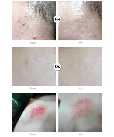  DAYCELL Machihyun 20 Calming Ampoule (Roll On) 9ml - Buy Online on GoSupps.com