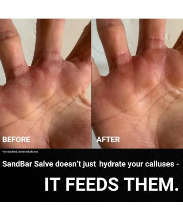 SandBar Natural Callus Salve - Revitalizing Callus Balm for Healing & Nourishing Calluses - On-the-Go Repair & Care - Immediate Relief for Callus Tears - 0.15 oz - Buy Online on GoSupps.com