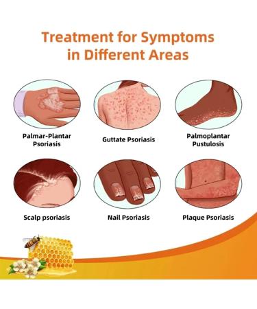 Professional Psoriasis Treatment Cream with New Zealand Bee Venom - Soothing & Moisturizing Formula - 5PCS - Buy Online on GoSupps.com