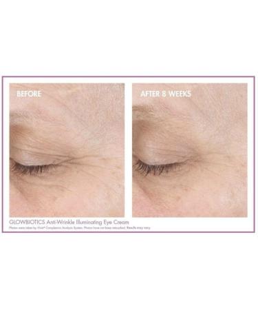 Glowbiotics Anti-Wrinkle Eye Cream - Reduces Dark Circles & Puffiness Fine Lines & Wrinkles | Probiotics & Antioxidants 0.5 Fl Oz - International Shipping Available - Buy Online on GoSupps.com