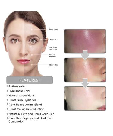 Eelhoe Vitamin C Serum Bundle with Hyaluronic Acid - Anti Aging & Melanin Correcting Formula - Buy Online on GoSupps.com