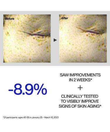 IOPE Retinol Expert 0.1% - Anti-Aging Serum with Pure Retinol Reduce Wrinkles & Fine Lines Pore Refining Ideal for Retinol-Experienced User Dermatologist Tested Korean Skincare 1.01 fl.oz. - Buy Online on GoSupps.com