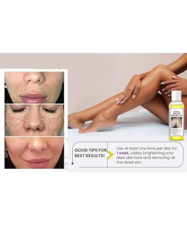 Yellow Peeling Oil Peeling Oil for Dark Skin Strong Peeling Oil Extra Strength Exfoliating Peeling Solution for Body All Skin Type - 110ML/3.66 OZ (2 PCS) - Buy Online on GoSupps.com