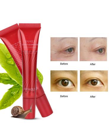 Buy Sonew Snail Repair Eye Cream - Ginseng Extract Eye Serum for Dark Circles Puffiness & Aging - Anti-Aging Skin Care Lotion - Buy Online on GoSupps.com
