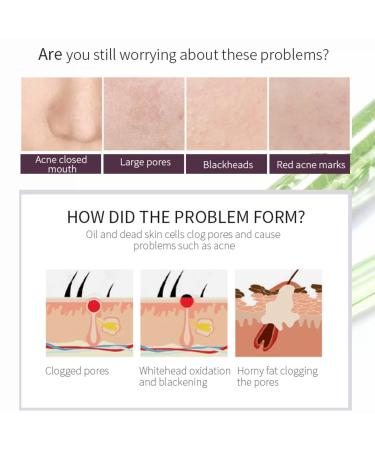 Buy AHA 30% + BHA 2% Exfoliating Facial Serum | Generic Peeling Solution for Blemishes & Pore Congestion - 1.0 Fl Oz/30ml (2 PCS) - International Shipping Available - Buy Online on GoSupps.com