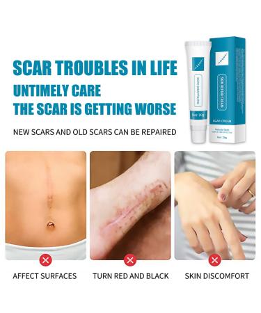 Acne Scar Treatment Gel - Scar Remover for Face & Body - 20g - Buy Online on GoSupps.com