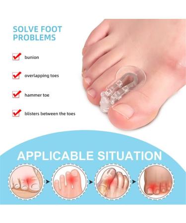 Breathable Toe Separators - 2 Pair Soft Gel Big Toe Spacers for Hallux Valgus, Bunions, and Hammer Toes - Buy Online on GoSupps.com