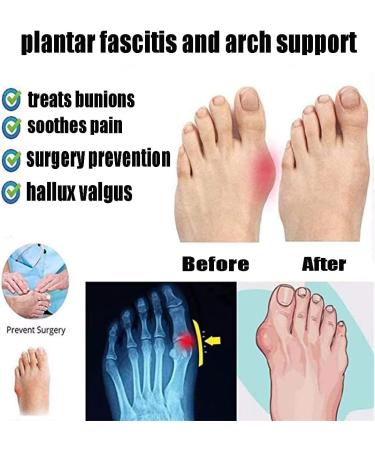 EEUK Women's Arch Support Orthotic Sandals - Black, Size 39 EU | Comfortable Platform Wedge & Flip Flops for Dressy/Casual Summer - Buy Online on GoSupps.com