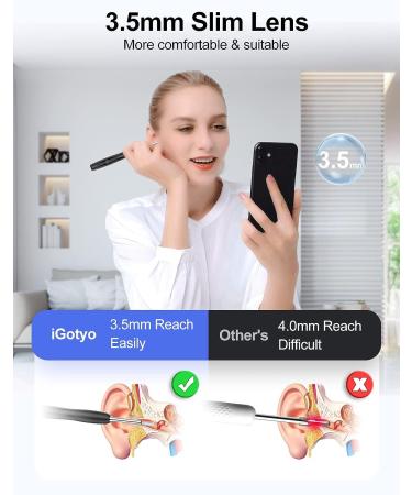 1080P FHD Ear Wax Removal Tool Camera with 6 LED Lights - Waterproof Endoscope for iPhone & Android - Ideal for Adult, Kids, and Pets - Black - Buy Online on GoSupps.com