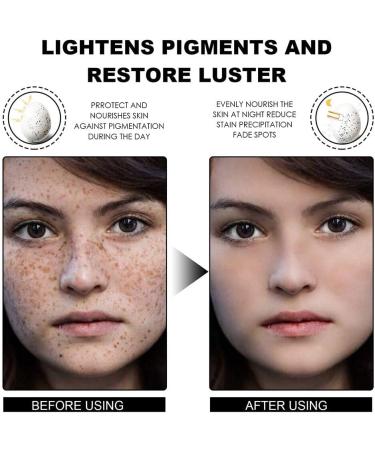 Dajidafu Women Face Anti-blackspot Ladies Whitening Moisturizing Blackspot Removal Essence Blemish Remover Beauty Supplies - Buy Online on GoSupps.com
