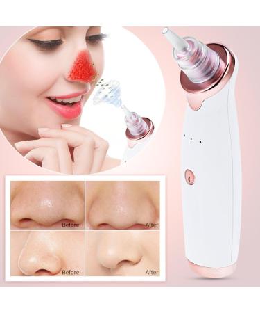 Blackhead Removal Device - Deep Cleansing for All Skin Types - Easy and Practical White Tool - Buy Online on GoSupps.com