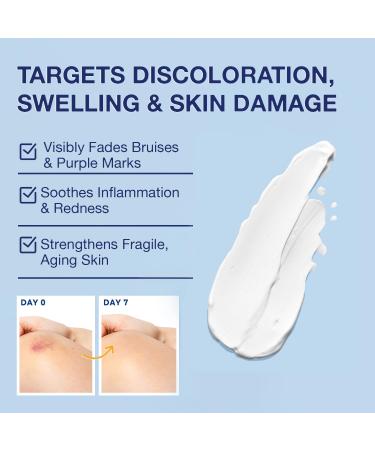 Arnica Bruise Cream Extra Strength Fast-Acting Arnica Montana with Vitamins K C & E for Bruising Swelling Discoloration & Thin Skin Hydrating Moisturizer for Face & Body 4 oz 4 Ounce (Pack of 1) - Buy Online on GoSupps.com