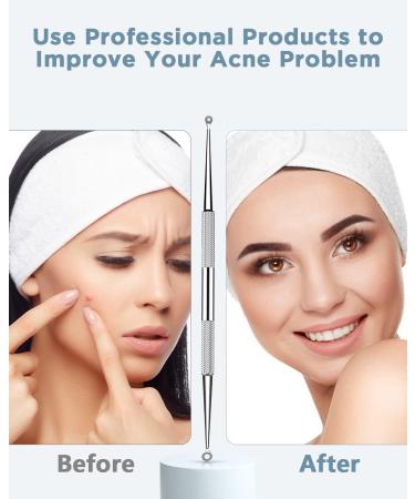 Blackhead Remover Tool Pimple Popper Tool Kit Blackhead Extractor tool for Face Extractor Tool for Comedone Zit Acne Whitehead Blemish Stainless Steel Extraction tools - Buy Online on GoSupps.com