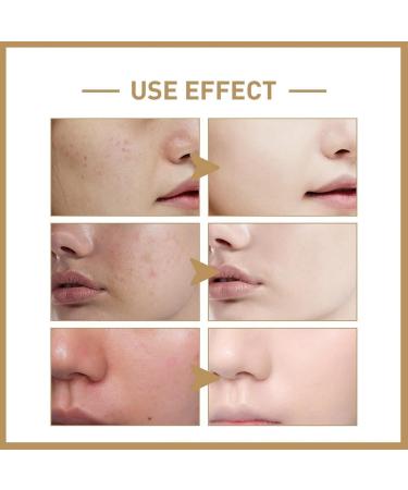 Hyaluronic Acid 2% + B5 Skincare Hyaluronic Acid Face Serum Moisturiser Face Face Serum For Women & Men To Plump & Smooth Skin Anti Aging Serum For Face Face Serums Skincare Serum Brightening Serum - Buy Online on GoSupps.com