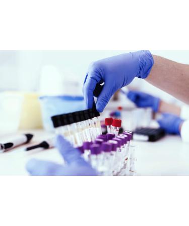 Buy Alcohol Test Strips - Urine Test Kit (3 Tests) | Fast International Shipping - Buy Online on GoSupps.com