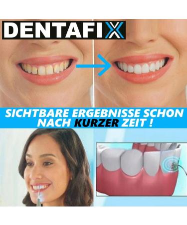 Dentafix Electric Tartar Remover - Ultra Sonic Tooth Cleaner & Plaque Removal Tool | Dental Care for Healthy Teeth - Buy Online on GoSupps.com