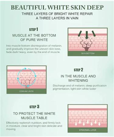 Dr. Hancy White Spot Corrector Cream for Dry Skin - Freckle Whitening & Moisturizing Face Cream (1PCS) - Buy Online on GoSupps.com