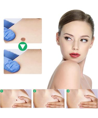 WATSKY Skin softening and foot care fluid for removing warts and corns gentle hypoallergenic formula 10 ml pack of 3 - Buy Online on GoSupps.com