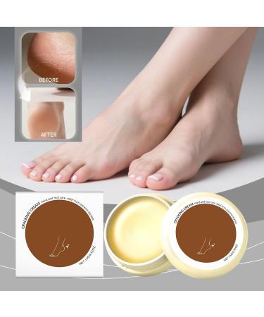 Dry Hand Cream | Anti-Freeze Repairing Lotion for Heels | Cream for Dry Feet for Dead Skin Women Men Seniors Athletes Toes Elbows Autumn - Buy Online on GoSupps.com