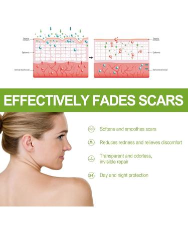 Goopgen Advanced Scar Repair Serum - Medical Grade Treatment for Surgical Scars, Stretch Marks, and Nature Scars (2PC) - Buy Online on GoSupps.com