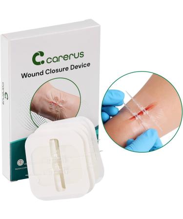 5pcs Zip Stitch Suture Free Wound Closure Strips | Butterfly Bandages for Emergency Laceration Repair - First Aid Kit Essential - Buy Online on GoSupps.com