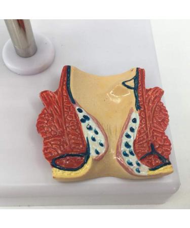 YOtat Human Pathological Hemorrhoids Model-Colorectal Hemorrhoid Lesion Model-Placed On The Base-is The Best Teaching Aid for Doctor-Patient Communication - Buy Online on GoSupps.com