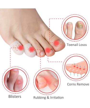 Toe Protection Silicone Caps - 20 Pcs Small Gel Cushions for Bubbles Chicken Eyes & Friction Relief | Breathable Toe Care - Buy Online on GoSupps.com