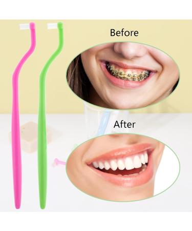 Buy Wllhyf 4-Piece Tuft Toothbrush Set | Soft Compact Interdental Brushes for Implants & Braces | International Shipping Available - Buy Online on GoSupps.com