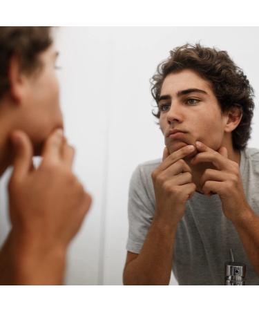 Envio Medical Grade BHA 2% Salicylic Acid Gel Serum - Natural Exfoliation Clear Whiteheads & Blackheads - 30 Day Supply 0.7 Fl Oz - International Shipping Available - Buy Online on GoSupps.com